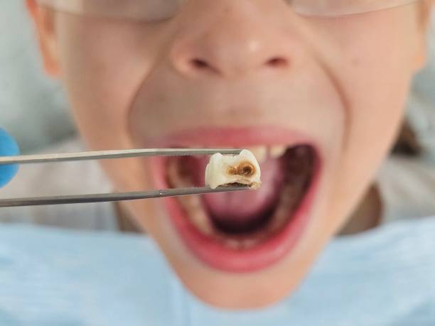 Best Emergency Dental Services for Seniors in Stratford, NJ